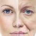 Rejuvenecimiento Facial